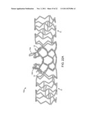 STENT WITH SELF-DEPLOYABLE PORTION HAVING WINGS OF DIFFERENT LENGTHS diagram and image