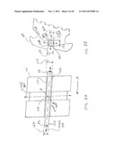 COMPENSATION ORTHODONTIC ARCHWIRE DESIGN diagram and image