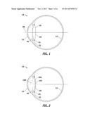 Apparatus, System and Method for Predictive Modeling to Design, Evaluate     and Optimize Ophthalmic Lenses diagram and image