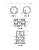 Media compaction compensating support system for pollutant stream     remediation reactors diagram and image