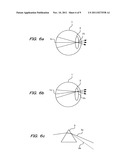 OPHTHALMOLOGIC PHOTOGRAPHY APPARATUS diagram and image