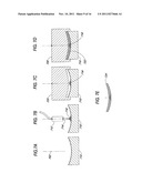 VISION CORRECTION LENSES diagram and image