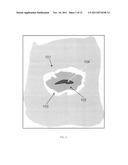 Image analysis for cervical neoplasia detection and diagnosis diagram and image