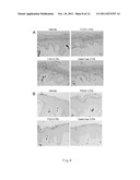 COMPOSITION FOR IMPROVING INFLAMMATORY DISEASE USING ABH ANTIGENS diagram and image