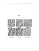 METHODS AND COMPOSITIONS FOR THE DIAGNOSIS AND TREATMENT OF EPITHELIAL     CANCERS diagram and image