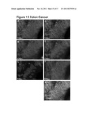 METHODS AND COMPOSITIONS FOR THE DIAGNOSIS AND TREATMENT OF EPITHELIAL     CANCERS diagram and image