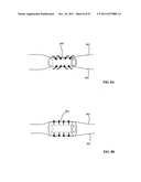 Lumen-traveling biological interface device and method of use diagram and image