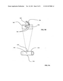 Lumen-traveling biological interface device and method of use diagram and image