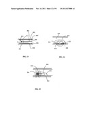 Lumen-traveling biological interface device and method of use diagram and image