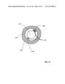 Lumen-traveling biological interface device and method of use diagram and image