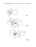 Lumen-traveling biological interface device and method of use diagram and image