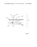 Lumen-traveling biological interface device and method of use diagram and image