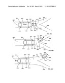 Lumen-traveling biological interface device and method of use diagram and image