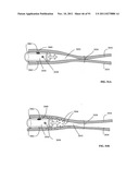 Lumen-traveling biological interface device and method of use diagram and image