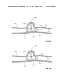 Lumen-traveling biological interface device and method of use diagram and image