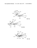 Lumen-traveling biological interface device and method of use diagram and image