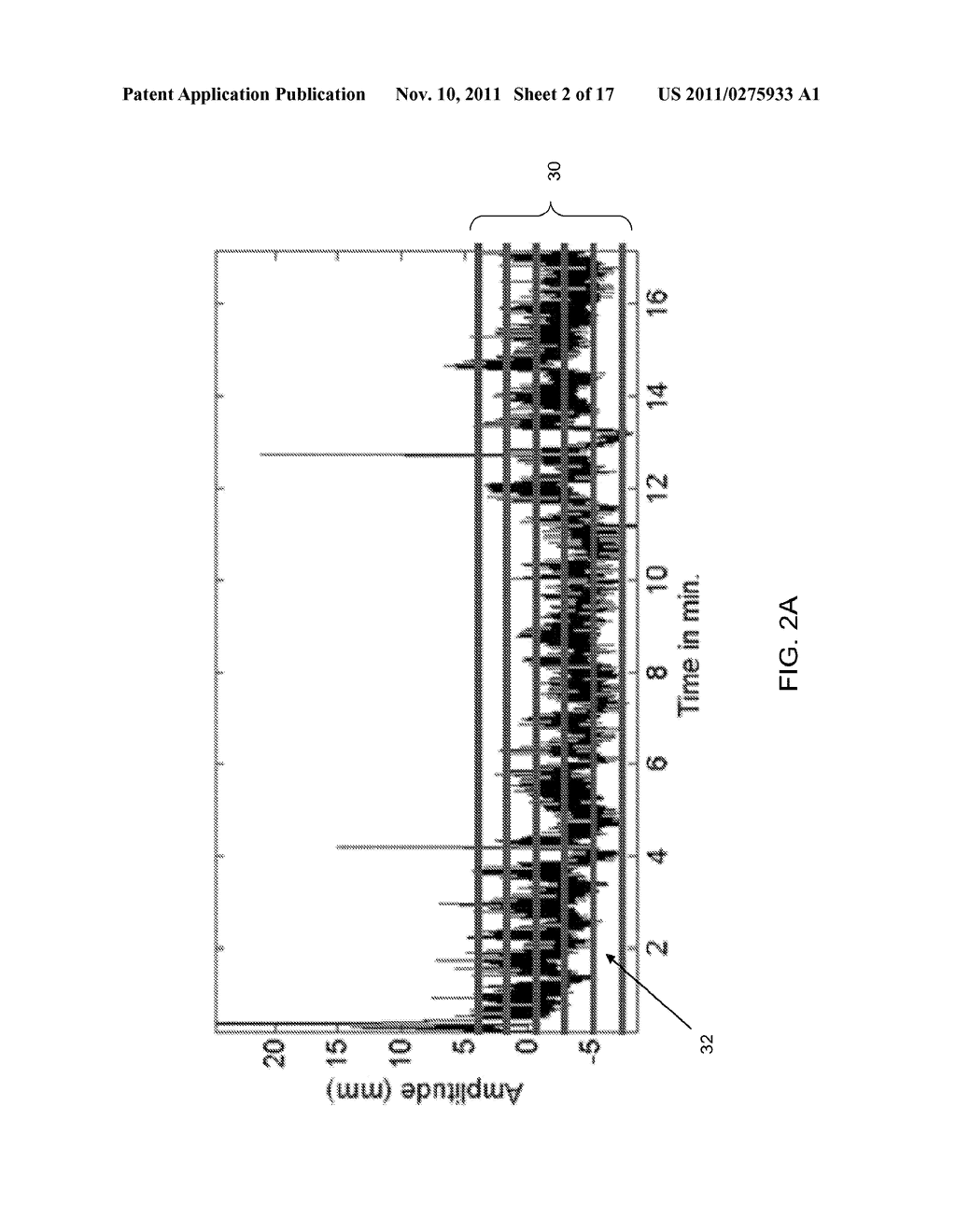 MOTION COMPENSATION IN NUCLEAR IMAGING - diagram, schematic, and image 03