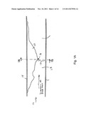 METHOD FOR DETERMINING SHEAR STRESS AND VISCOSITY DISTRIBUTION IN A BLOOD     VESSEL diagram and image