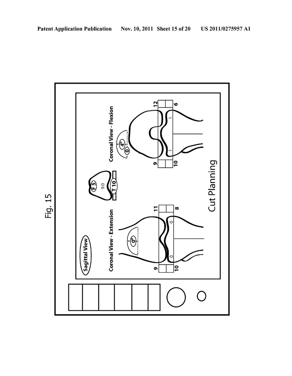 Inertial Sensor Based Surgical Navigation System for Knee Replacement     Surgery - diagram, schematic, and image 16