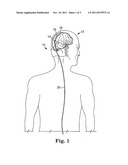 ANTI-THROMBOGENIC VENOUS SHUNT METHOD diagram and image