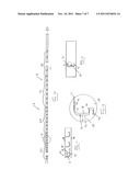 STEERABLE STYLET diagram and image