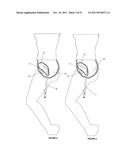 Cystotomy Catheter Capture Device diagram and image