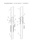 Cystotomy Catheter Capture Device diagram and image