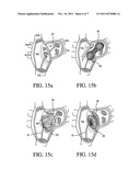 Atrial Septal Occluder Device and Method diagram and image