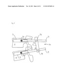 FIXATION ASSEMBLY FOR SPINAL VERTEBRAE diagram and image