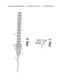 Vascular Device For Use During An Interventional Procedure diagram and image