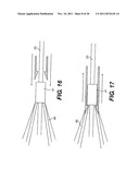 Vascular Device For Use During An Interventional Procedure diagram and image