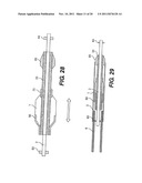 Vascular Device For Use During An Interventional Procedure diagram and image