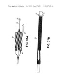 Vascular Device For Use During An Interventional Procedure diagram and image