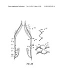 REPLACEMENT VALVE AND ANCHOR diagram and image