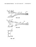 REPLACEMENT VALVE AND ANCHOR diagram and image