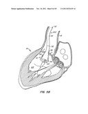 REPLACEMENT VALVE AND ANCHOR diagram and image