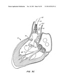 REPLACEMENT VALVE AND ANCHOR diagram and image