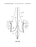 REPLACEMENT VALVE AND ANCHOR diagram and image