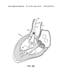 REPLACEMENT VALVE AND ANCHOR diagram and image