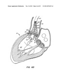 REPLACEMENT VALVE AND ANCHOR diagram and image