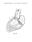 REPLACEMENT VALVE AND ANCHOR diagram and image