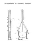 REPLACEMENT VALVE AND ANCHOR diagram and image