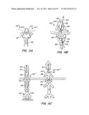 REPLACEMENT VALVE AND ANCHOR diagram and image