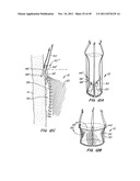 REPLACEMENT VALVE AND ANCHOR diagram and image