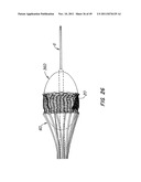 REPLACEMENT VALVE AND ANCHOR diagram and image