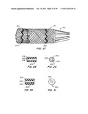 REPLACEMENT VALVE AND ANCHOR diagram and image