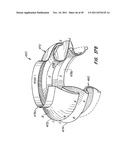 REPLACEMENT VALVE AND ANCHOR diagram and image