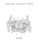 REPLACEMENT VALVE AND ANCHOR diagram and image