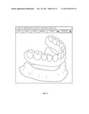 Computer-aided Fabrication Of A Removable Dental Prosthesis diagram and image