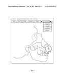 Computer-aided Fabrication Of A Removable Dental Prosthesis diagram and image